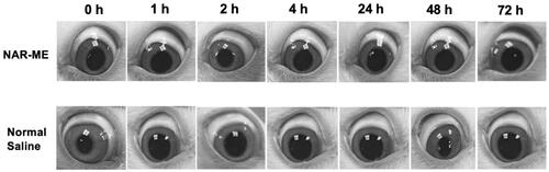 Figure 7. Local ocular reaction observed under slit lamp microscope after in vivo single instillation of 0.5% NAR-ME or normal saline (served as control).