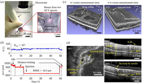 Figure 10. Injection results on an ex-vivo porcine eye. (a) Experimental setup image of the porcine eye injection and the microscopic image of the sensorized needle. (b) Representative θ and pos measurement results during the ex-vivo porcine eye experiment. (c) 3D OCT images of the injected ex-vivo porcine eye (c1) with cosine measurement error and (c2) without cosine measurement error. (d) 2D OCT images: (d1) en-face image of the injected layer and cross-section images of both (d2) non-injected and (d3) injected area.