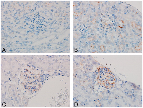 Figure 1. IHC score of granular deposits within glomerular tufts. For each of the four staining targets (BSA, mIgG, mIgM, and C3d), frequency of granular staining within the glomerular tuft was evaluated from mice dosed with (A) vehicle or (B–D) bovine serum albumin (BSA). A score 0 (A) was assigned if no granular was observed; score 1 (B) if granular staining was shown as mild; score 2 if shown as moderate (C); or score 3 if shown as severe (D) in at least three glomeruli within the IHC cross section. Original objective 60×.