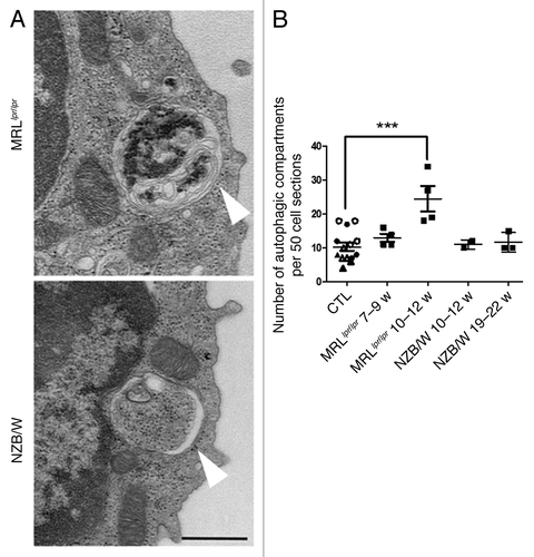 Figure 3. Increased number of autophagic vacuoles in peripheral T cells isolated from lupus mice compared with control mice. (A) Representative autophagic vacuoles indicated by white arrows, in peripheral T cells from lupus MRLlpr/lpr and NZB/W mice. Scale bar stands for both images (black scale bar: 500 nm). (B) Quantification by TEM of autophagosomes counted in 50 peripheral T lymphocyte sections sorted from spleens of control (7–8 week-old CBA/J mice (open circles), 10–12 week-old CBA/J mice (filled circles), 10–12 week-old BALB/c mice (open triangles) and 20–22 week-old BALB/c mice (filled triangles), MRLlpr/lpr and NZB/W lupus mice. Mice were sacrificed at the indicated ages. Each point represents measurement of an individual mouse. Central bars refer to the mean and vertical bars stand for standard deviation. ***p < 0.001 using unpaired t-test, w = week.