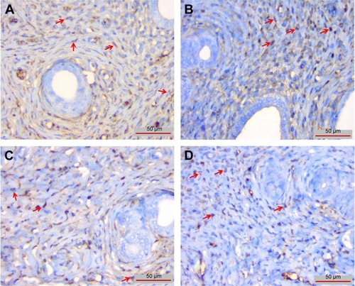 Figure 6 CASP3 immunoreactivity was observed in endometrial stromal cells (red arrows).