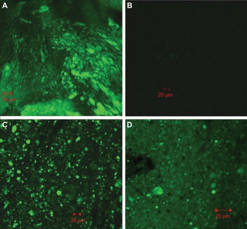 Figure 5 Disposition of coumarin-6 microcapsules in the gastrointestinal tract at different time after oral administration. (A): 4 h, ileum; (B) 6 h, ileum; (C) 6 h, colon; (D) 12 h, colon.