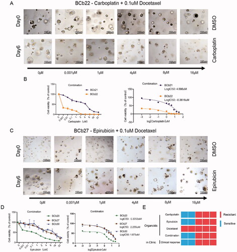 Figure 6. Patient-derived organoids show different sensitivities to the combination of epirubicin and docetaxel and the combination of carboplatin and docetaxel. (A,C): The bright field shows the changes in the size and status of organoids treated with different drug concentrations of carboplatin and 0.1 μM docetaxel (the upper row represents the organoids without drug treatment, and the lower row represents the organoids treated with different drug concentrations for six days). Scale bar, 150 mm. (B): The line graph shows the survival rate and IC50 of carboplatin combined with docetaxel in the treatment of HER2-positive organoids. (C): The bright field shows the changes in the size and status of organoids treated with different drug concentrations of epirubicin and 0.1 μM docetaxel (the upper row represents the organoids without drug treatment, and the lower row represents the organoids treated with different drug concentrations for six days). Scale bar, 150 mm. (D): The line graph shows the survival rate and IC50 of the combined treatment of epirubicin and docetaxel in HER2-negative organoids. (E): The organoid response data matches the patient’s clinical results (the first row: the sensitivity of HER2-positive organoids to epirubicin; the second row: the sensitivity of HER2-negative organoids to epirubicin; the third row: The bottom of the sensitivity of different types of organoids to docetaxel; the fourth row: the drug reactivity of the two-drug combination of different types of organoids; bottom: the heat map of the organoid response and the patient’s clinical results, we can draw the conclusion that organoids can predict the prognosis of patients with neoadjuvant chemotherapy).