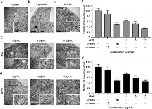 Figure 4. Electron microscopy detection of intracellular melanin production.