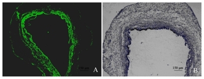 Figure 7 Rabbit CCA results demonstrating GFP transduction in arterial wall: A) Example of GFP expression following NP-stent implanting (FITC; 50×); B) Immunohistochemical confirmation of GFP expression (immunoperocidase; 50×).