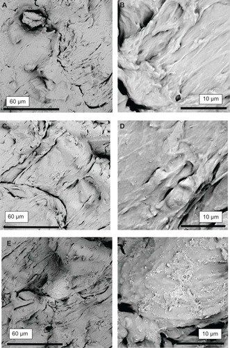 Figure 5 Scanning electron micrographs showing CHX-HMP nanoparticles on EVA polymer. (A, B) Control (no nanoparticles); (C, D) CHX-HMP-0.5 nanoparticles; (E, F) CHX-HMP-5 nanoparticles. The untreated EVA had a textured appearance (A, B). The CHX-HMP-0.5 surface was not clearly different from the control (C, D); there was no evidence of aggregations of nanoparticles as with the other material specimens. The CHX-HMP-5 surface displayed deposits of the porous aggregate coating much of the polymer surface (E, F).Abbreviations: CHX, chlorhexidine; HMP, hexametaphosphate; EVA, ethylene vinyl acetate.