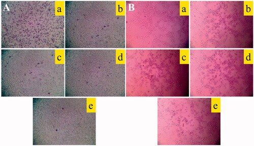 Figure 6. Destructive effects on VM channels and blocking effects on A549 cells migration in vitro after treatment with varying formulations. (A) Blocking effects on A549 cells migration; (B) destructive effects on VM channels, (a) blank control; (b) epirubicin liposomes; (c) dihydroartemisinin liposomes; (d) epirubicin–dihydroartemisinin liposomes; (e) R8 modified epirubicin–dihydroartemisinin liposomes.