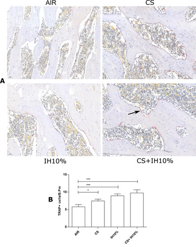 Figure 3 TRAP staining and quantitative analyses of osteoclasts in femoral tissues. (A) TRAP staining of femoral tissues in each group (Scale bar=50 µm). TRAP-positive osteoclasts were stained red, and the nuclei were light blue. Arrows indicate TRAP-positive osteoclasts. (B) Numbers of TRAP-positive osteoclasts, measured as cells per millimeter of perimeter (cells/B.Pm). Data presented as mean ± SD (n=5 per group). * P <0.05; *** P <0.001.