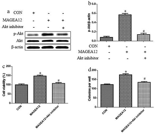 Figure 2. MAGEA12 promotes Akt signaling to induce growth of OSCC cells. MAGEA12 plasmid was transfected into Cal-27 cells for 24 h, and then cells were treated with Akt inhibitor MK-2206 (2 μM) for 12 h. Levels of Akt and p-Akt were (a) determined by western blot and (b) quantitated. Then assessed for (A) viability using the CCK8 assay and (B) colony formation. *P < 0.05 vs control group (CON). #P < 0.05 vs MAGEA12 overexpression group (MAGEA12)