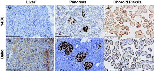 Figure 7. Staining of TTR by the 14G8 mis-TTR mAb in normal tissue known to express TTR. 14G8 did not stain the TTR present in normal human liver (A) but did stain intracellular TTR present in normal pancreatic α-cells (B) and choroid plexus (C) from normal donors. Staining of tissue with 14G8 was specific as demonstrated by the lack of staining in adjacent sections using an isotype control antibody (data not shown). This is in contrast to staining of TTR using the Dako antibody which stained total TTR present in all three of these normal tissue types (D–F). Scale bar = 250 μm.