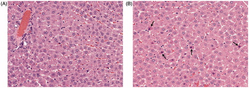 Figure 1. Hepatocyte necrosis in Harlan Sprague–Dawley rats exposed to PFDA for 28 d. Liver tissue from PFDA-treated and control rats was fixed in 10% neutral buffered formalin and evaluated using enhanced histopathology guidelines (see Methods section). Liver of (A) control or (B) rat treated with 0.5 mg PFDA/kg/d. Centrilobular, single cell, hepatocyte necrosis (arrows) was present in 3/8 rats and of minimal severity (grade 1.0). Note randomly scattered shrunken hepatocytes containing hyper-eosinophilic cytoplasm with small-to-occasionally pyknotic nuclei.