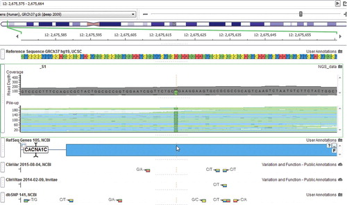 Figure 2. Exon 12 of the CACNA1C gene in our second patient.