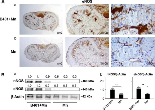 Figure 3 Cavernosal levels of nitric oxide synthases in Mn-treated mice with and without oral B401 treatment.