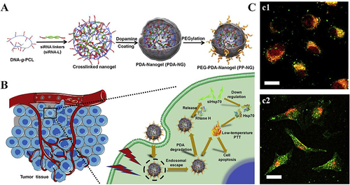 Figure 4 (A) Schematic illustration of PDA-coated nucleic acid nanogel with PEGylated surface (PEG-PDA-Nanogel). (B) The mechanism of siRNA-mediated low-temperature photothermal therapy induced by PEG-PDA-Nanogel in vivo. (C) The cellular uptake behaviour and gene silencing of PP-NGs in vitro. (c1) In vitro cellular uptake behaviour of FAM-labelled PP-NGs analyzed by flow cytometry (with equivalent FAM concentration of 1 μM). (c2) Endolysosomal escape of PP-NGs after laser treatment. Red: endolysosome stained with LysoTracker Red DND-99; green: PP-NG-siRNA labelled with FAM; yellow: colocalization of PP-NGs and endolysosome. The inset bars represent 25 μm. Reprinted from Biomaterials, 245, Ding F, Gao X, Huang X, et al. Polydopamine-coated nucleic acid nanogel for siRNA-mediated low-temperature photothermal therapy Copyright 2020, with permission from Elsevier.Citation54