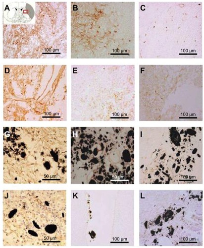 Figure 8 Immunostaining was performed with CD11b/c (OX-42) to reveal the expression of activated microglial cells (evidenced by brown-stained cells) (A, D, G, J) 1 week, (B, E, H, K) 3 weeks, and (C, F, I, L) 5 weeks after middle cerebral artery occlusion injury. The experimental groups included (A–C) the experimental control group (without subventricular zone neural progenitor cell transplantation) and the (D–F) subventricular zone neural progenitor cells alone, (G–I) hydrophilic carbon nanotubes impregnated with subventricular zone neural progenitor cell, and (J–L) hydrophobic carbon nanotubes impregnated with subventricular zone neural progenitor cell transplantation groups.Notes: Scale bars =100 μm. Carbon nanotubes appear black.