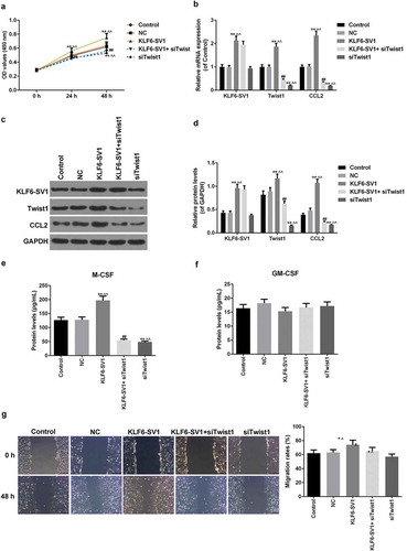 Figure 4. Effects of co-transfection of KLF6-SV1 and siTWIST1 on A549 cells.(a) CCK-8 assay was used to tested the cell viability. (b-d) KLF6-SV1, TWIST1 and CCL2 proteins and mRNAs levels at 48 h after tansfection were tested by Western blot and qRT-PCR. (e, f) ELISA was applied to detect the M-CSF and GM-CSF expressions at 48 h after tansfection. (g) Migration rate at 48 h after tansfection was detected using Transwell assay. *P < 0.05,**P < 0.01, versus control group; ^P < 0.05, ^^P < 0.01, versus NC group.