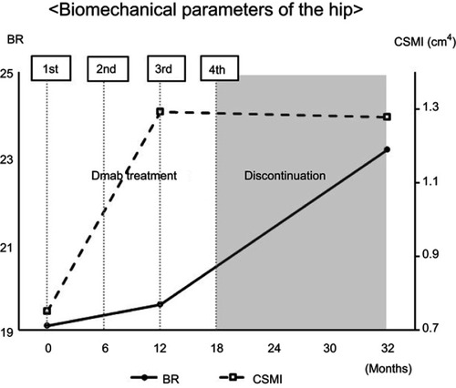 Figure 5 Biomechanical parameters of the hip measured by QCT. QCT revealed that the BR (index of cortical instability) increased and CSMI (index of bending strength) decreased after discontinuation of denosumab treatment.