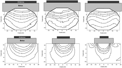 Figure 5. Contour plots of the E-field (Z-component) of the 20 × 34, 15 × 34 and 8.5 × 34 cm antennas (from left to right). The top row shows the distributions in the central transversal XY-plane and the bottom row the distributions in the sagittal YZ-plane (Figure 3). The Z-component of the E-field in the centre of the phantom was normalised to 100%.