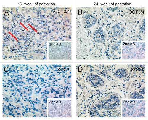 Figure 3 Immunohistochemical staining of testis sections at week 19 (A and C) and 24 (B and D) of gestation for OCT3/4 (A and B) and SOX2 (C and D). Arrows indicate cells positive for OCT3/4. Scale bar: 50 µm.