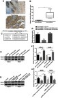 Figure 6 HOXA11-AS could up-regulate the expression of its target gene Rab3D by down-regulating miR-125a-5p expression. (A) Immunohistochemical results showed that the expression level of Rab3D in tumor tissues was higher than that in their adjacent tissues. (B) RT-PCR results showed that the expression level of Rab3D in tumor tissues was significantly higher than that in their adjacent tissues (**P<0.01). (C) The TargetScan software analysis showed that miR-125a-5p may be combined with 3 ‘UTR of Rab3D. (D) Luciferase reporter gene analysis showed that miR-125a-5 could target the 3’UTR of Rab3D (**P<0.01). (E, F) miR-125a-5p could inhibit the expression of Rab3D in OS cell lines (*P<0.05, **P<0.01). (G, H) HOXA11-AS could promote the expression of Rab3D by inhibiting the expression of miR-125a-5p in OS cell lines (*P<0.05, **P<0.01).