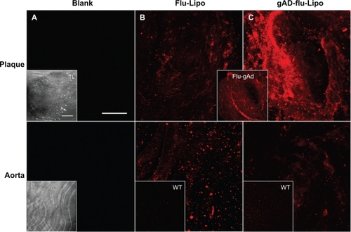 Figure 2 The staining signal of liposomal nanoparticles at atherosclerotic plaques is enhanced by globular adiponectin. Aortic sections of apolipoprotein E-deficient and C57Bl6/J wild type mice were incubated with Atto655-labeled stealth liposomes as controls (B), or with gAd-coupled Atto655-labeled liposomes (C). Blank sections are shown in (A). The upper panels correspond to plaque regions, while the lower panels show the signals in artery sections without plaques. The inserts (B, C) show the weak fluorescence signals from stained wild type aortic tissue. Transmitted light images of the aortic sections are shown in (A) (inserts). The insert between (B) and (C) displays the accumulation of Atto655-labeled gAd at atherosclerotic plaques for comparison. Sections were placed between a glass slide and a cover slip and visualized by confocal laser scanning microscopy (fluorescence and transmitted light). For each visualization, a series of 20–30 fluorescence images in Z (1 μm consecutive intervals) were projected in a single image. Both bars indicate 50 μm.Abbreviation: gAd, globular domain of adiponectin.