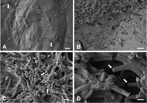 Figure 3. Field emission scanning electron micrographs of orange plaques on the bark of Cornus controversa. Orange plaque surface, which showed microcracks (arrows) and was overall less undulating than the bark surface. Scale bar = 200 μm (A), magnified view of the orange plaque. There were differences in textures and surface height. Scale bar = 50 μm (B), yeast forms (arrows). They were lemon- or club-shaped, and often formed clusters on the microbial mat. Note the mucilage (arrowheads) among filamentous forms. Scale bar = 10 μm (C), magnified view of filamentous forms. Filamentous forms were disconnected (arrows). Scale bar = 5 μm (D).