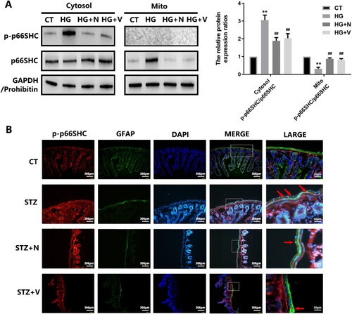 Figure 6. Hyperglycemic stress induces p66SHC activation in EGCs in vitro and in vivo. A: CRL-2690 cells were pre-treated with RAC1 inhibitor (NSC23766, 80 μM, 6 h) or NOX inhibitor (VAS2870, 10 μM, 6 h) for 12 h, and then treated with high glucose (200 mM) for another 12 h. The protein expression and distribution of p-p66SHC and p66SHC were evaluated using western blot analysis. CT: control (5.6 mM), HG: high glucose (200 mM). B: Diabetic mice (2 weeks post STZ-injection) were intramuscularly injected with NSC23766 (150 μM/every 3 d/4 weeks) or VAS2870 (50 μM/every 3 d/4 weeks). The expression of p-p66SHC in EGCs were assessed using immunofluorescence analysis (p-p66SHC: red fluorescence, GFAP: green fluorescence, DAPI: blue fluorescence). ** p < 0.01 vs. CT. ## p < 0.01 vs. HG. CT: control (<100 mg/dL); STZ: DM (>300 mg/dL) (6 weeks post STZ-injection).