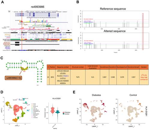 Figure 3 Integrated analysis of the leading m6A-SNP rs4993986. (A) The protein coding region of rs4993986 in HLA-DQB1 gene sequence shows high transcriptional activity and DNaseI hypersensitivity. RNA-binding protein analysis revealed that rs4993986 exhibited a binding region to the RBP PABPC1. (B) Prediction of m6A modification on the HLA-DQB1 transcript (ENST00000434651.6) on the SRAMP website. (C) The secondary structure of HLA-DQB1 transcript and the position of rs4993986 near the m6A modification site. (D) The expression of HLA-DQB1 (H2-Ab1) was identified in the mouse pancreas scRNA-seq data. Violin plot shows that HLA-DQB1 expression is increased in diabetic islet acinar cells. (E) HLA-DQB1 expression of different cell types in islet of diabetes and control group.