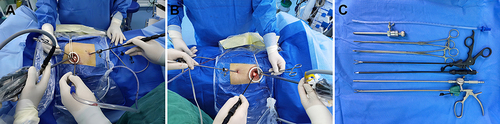 Figure 1 Surgical layout for the implementation of LVATS. (A) Configuration for left lung surgery. (B) Arrangement for right lung surgery, with appropriate modifications for operative access based on the surgeon’s preference. (C) Essential instruments used in LVATS.