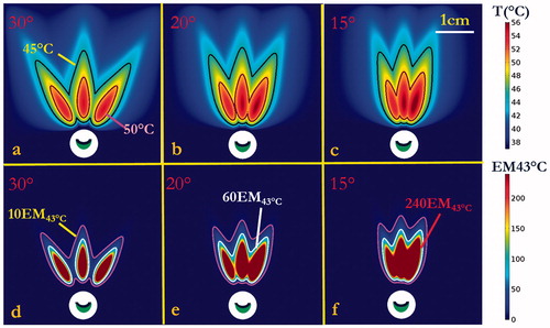 Figure 6. Thermal simulation of maximum temperature and thermal dose of generic tissue using the curvilinear ultrasound applicator for sequential three-shot sonication patterns. (a–c) Maximum temperature with 30°, 20° and 15° sequential rotations are shown respectively, with 45 °C (magenta) and 50 °C (black) contours. (d–e) Corresponding thermal dose with 30°, 20° and 15° sequential rotations are shown, respectively, with contours of 10 EM43 °C (magenta), 60 EM43 °C (white) and 240 EM43 °C (red). (The display of thermal dose was set at a maximum threshold of 240 EM43 °C for visualization purposes).