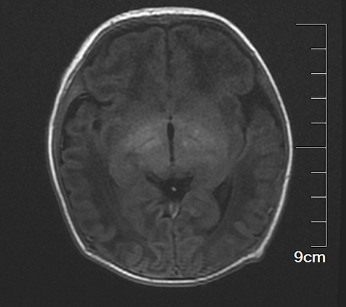 Figure 2 Cranial magnetic resonance imaging.