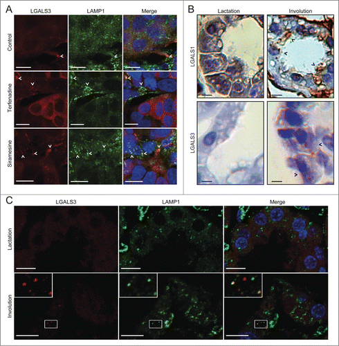 Figure 7. The galectin puncta assay detects LMP in paraffin-embedded tissue samples. (A) Sections of MCF7 breast cancer xenografts collected from SCID/FOX mice 48 h after p.o. treatment with 100 mg/kg terfenadine or siramesine or vehicle (200 µl of 0.5% methyl cellulose 15 in 0.9% NaCl solution) were costained with rat anti-LGALS3 (red) and mouse anti-LAMP1 antibodies (green) and Hoechst 33342 (blue) and analyzed by confocal microscopy. Representative maximum projection images of z-stacks are shown. Examples of puncta positive for both LGALS3 and LAMP1 are indicated by arrowheads. Two biological replicas showed similar results. See Figure S3A for images of galectin puncta formation in paraffin-embedded MCF7 cell pellets. (B) Sections of lactating (10 d) and involuting (24 h) mouse mammary gland tissues from C57B6/J wild type mice were stained with rabbit anti-LGALS1 or rat anti-LGALS3 antibodies. Representative images of chromogenic staining with HRP-linked secondary antibodies and diaminobenzidine (brown) and hematoxylin counterstain (blue) are shown. Black arrowheads indicate examples of cells with LGALS1 or LGALS3 puncta. Two biological replicas showed similar results. See Figure S3B for lower magnifications of the LGALS1 samples and control IgG staining. (C) Representative maximum projection images of confocal microscopy z-stacks of mammary gland sections [described in (B)] stained with rat anti-LGALS3 (red) and mouse anti-LAMP1 antibodies (green). Nuclei were labeled with Hoechst 33342 (blue; in merged images). Two biological replicas showed similar results. Scale bars: 10 µm.