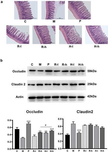 Figure 1. The improvement of intestinal mucosal permeability. (a) Effects on small intestinal villi; (b) Effects on intestinal tight junction proteins in the intestinal epithelium. C, control group; M, model group; P, positive group; R-l, raw licorice low dose group; R-h, raw licorice high dose group; H-l, honey-roasted licorice low-dose group; H-h, honey-roasted licorice high-dose group. *p < .05, **p < .01 ***p < .001 vs. M; #p < .05, ##p < .01, ###p < .001 R-l vs. H-l, R-h vs. H-h (n = 3).