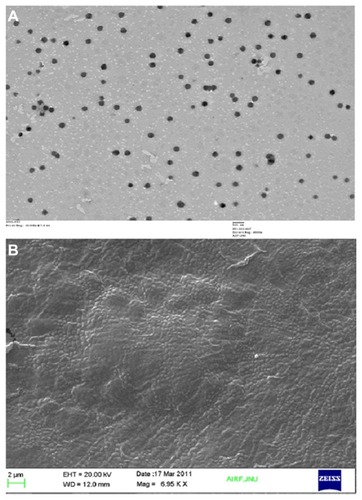 Figure 4 Transmission electron (A) and scanning electron (B) microscopy study of optimized nanoparticles.