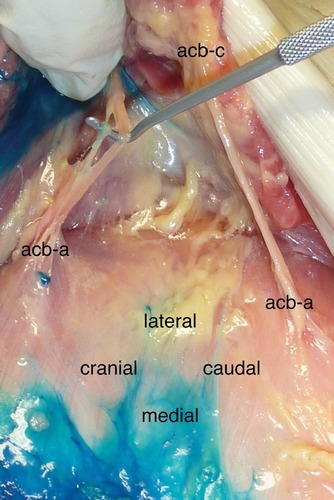 Figure 4 Anterior cutaneous branches (acb) without staining (injection from medial).