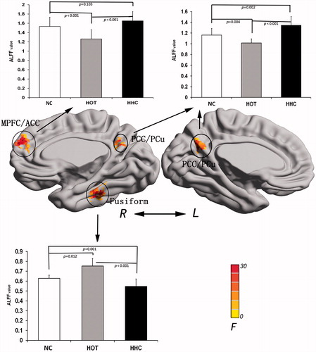Figure 1. Result of ALFF analysis under NC, HOT and HHC conditions. The brain region with significant ALFF difference involved in the right MPFC/ACC, bilateral PCC/PCu and right fusiform gyrus. MPFC/ACC: medial prefrontal cortex/anterior cingulate cortex; PCC/PCu: posterior cingulate cortex/precuneus; Fusiform: fusiform gyrus.
