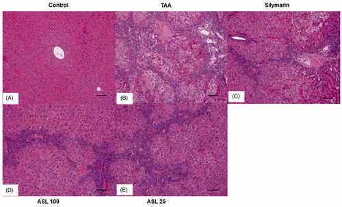 Figure 5. Effect of ASL on TAA-induced morphology of liver tissues by Hematoxylin and Eosin (H&E) staining. Hepatic sections stained with H&E (A–E) (×200). (A) Control, (B) TAA: TAA-induced liver fibrosis rats, (C) silymarin: positive control rats, (D) ASL 100: TAA plus ASL 100 mg/kg treated rats and (E) ASL 25: TAA plus ASL 25 mg/kg treated rats, Scale bar = 200 μM.
