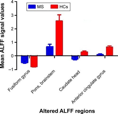 Figure 2 Beta values of different ALFF brain areas.