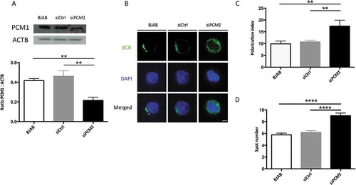 Figure 9. PCM1 is required for B cell polarization after BCR engagement. (a) BJAB cells were transfected with control siRNA, or siRNA targeting PCM1. Transfected and non-transfected BJAB cells were lysed. Top: PCM1 expression was assessed by immunoblot and loading control with ACTB staining was performed. Bottom: PCM1:ACTB intensity ratios were calculated. Means are shown in corresponding histograms, with bars standing for SEM. **P < 0.01 Mann-Whitney U test, N = 4). (b) Representative images obtained for the analysis of BCR localization stimulation by a soluble anti-human IgM at 60 min in non-transfected BJAB cells, or cells transfected with control siRNA (siCtrl) or siRNA directed against PCM1 (siPCM1). Images taken with x100 objective. (c) Polarization index of the BCR staining after stimulation in BJAB cells, or cells transfected with control siRNA (siCtrl) or siRNA directed against PCM1 (siPCM1). This index is the relative angle formed between the center of mass of the cell and the extremes of the staining distribution (Bars represent mean values per individual experiments ±SEM; **P < 0,001, Mann-Whitney U test. N = 4. (d) Quantification of the amount of BCR spots formed after stimulation in BJAB cells, or cells transfected with control siRNA (siCtrl) or siRNA directed against PCM1 (siPCM1). Bars represent mean values per cell ±SEM; ****P < 0.0001 Student test. N = 100 cells. Scale bar: 2 µm.