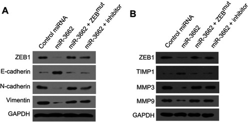Figure 6 miR-3662 inhibits EMT-related or invasive growth-related gene protein expression in A375 cells. (A) ZEB1, E-cadherin, N-Cadherin and Vimentin protein levels expressed in A375 cells transfected with control miRNA, miR-3662, miR-3662+ ZEB1Mut, or miR-3662+ miR-miR-3662 inhibitor determined by Western blot analysis. (B) ZEB1, TIMP-1, MMP3 and MMP9 protein levels expressed in A375 cells transfected with control miRNA, miR-3662, miR-3662+ ZEB1Mut, or miR-3662+ miR-miR-3662 inhibitor determined by Western blot analysis. *P<0.05.