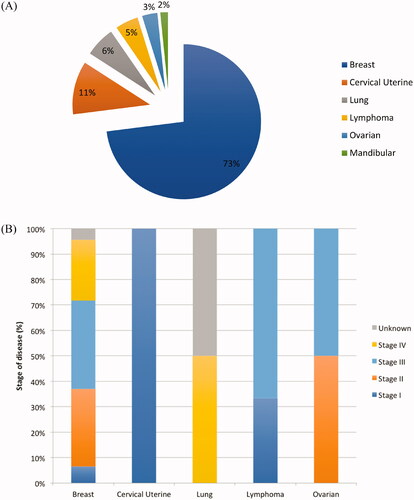 Figure 1. Distribution of cancers in study population (A) and stage of disease at diagnosis by cancer type (B) (n = 63).