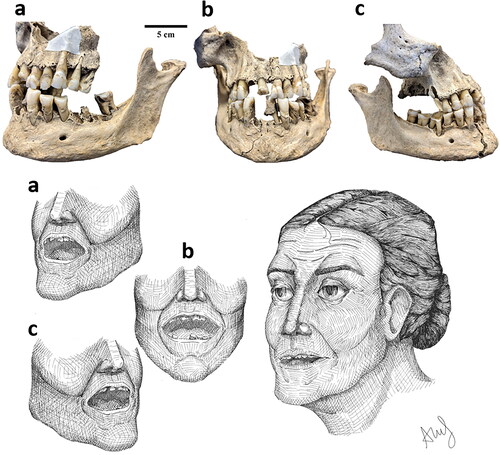 Fig 7 HRU 4142: Juxtaposition of skeletal images and artistic reconstructions. a) Right aspect of face and oral cavity; b) Anterior aspect; c) Left aspect. Photographs by Trent Trombley and drawings by Alexandra Farnsworth.
