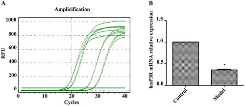 Figure 2. qPCR analysis of InsP3R mRNA expression. (A) Results of PCR amplification. (B) InsP3R mRNA relative expression of control group and model group. *InsP3R mRNA expression in the model group was significantly lower compared with the control/normal group (p < .05).