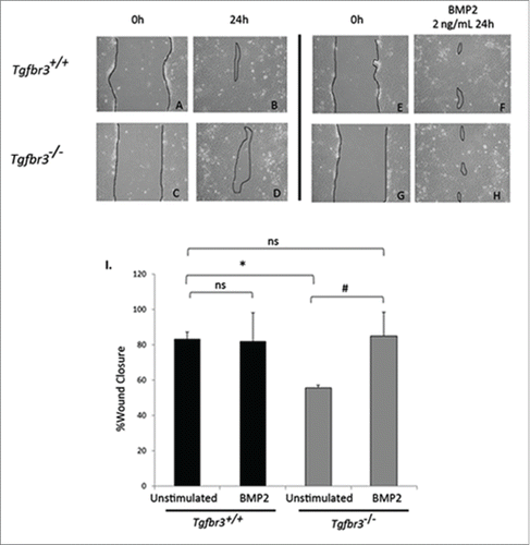 Figure 2. BMP2 rescues Tgfbr3−/− deficient cell migration. Wild-type (A-B, E-F) and Tgfbr3−/− (C-D, G-H) epicardial cells allowed to migrate for 24 hours in the presence (E-H) or absence (A-D) of BMP2 (2 ng/mL) in the wound healing assay. (*=p < 0.0005, #=p < 0.05).