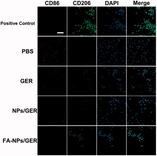 Figure 5. Confocal laser scanning microscopy images of macrophages after treatment with PBS, GER, NPs/GER, and FA-NPs/GER. Cell nuclei were stained with DAPI (blue), CD86 fluorescence displayed in red and CD206 fluorescence displayed in green. Scale bar represents 20 μm. Data represent mean ± SD (n = 3).