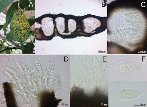 Fig. 5 Telimena canafistulae on Cassia fistula. A, Symptoms on adaxial side of leaf. B, Section through pseudostroma. C, Section through ostiolar region. D, Asci. E, Paraphyses. F, Ascospores.