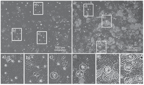 Figure 4. Merged images captured with bright-field microscopy and fluorescent microscopy set to an emission wavelength of 515 nm for an A549 cell culture dosed with (objects that appear small, circular, and white) after (i) 2-hour incubation and (ii) 18-hour incubation and immunocytochemistry work-up. Image (ii) also combines a fluorescent microscopy image at an emission wavelength of 590 nm to illustrate ICAM-1 expression by cells (regions that appear light in gray-scale false color) versus no ICAM-1 expression (regions that appear dark in gray-scale false-color). Subset boxes a, b and c, as well as d, e and f are selected regions of (i), and (ii), respectively. Circles show particle aggregates.
