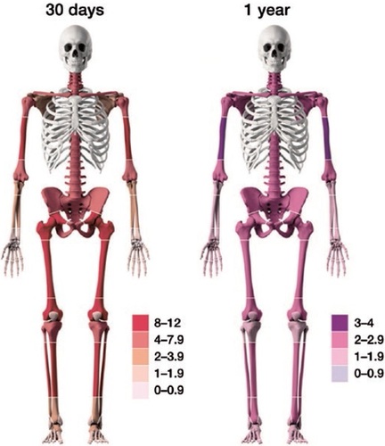 Figure 1. 30-day (left) and 1-year (right) SMR in different body locations illustrated with color intensity, based on SMR figures. Cut-offs and SMR color codes are different for 30-day and 1-year SMR.