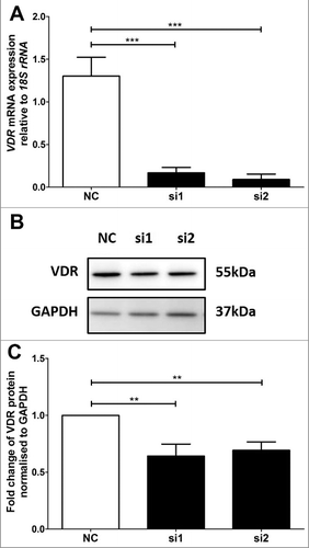 Figure 1. VDR siRNA knockdown in HTR-8/SVneo trophoblast cell line. A: Reduction of VDR mRNA expression after siRNA transfection at 48 hours. B: Representative immunoblot of VDR protein and GAPDH as loading control at 47kDa and 37kDa respectively. C: Protein quantitation of VDR expression at 48 hours. The graphs depict results from n≥3 independent experiments. Data presented as mean ± SEM. **p<0.01, ***p<0.001, One way ANOVA with Bonferroni's post-test.