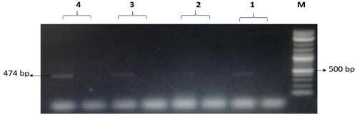 Figure 9. The amplified fragment of CTX-M9 gene with 474 bp, where M (DNA ladder =100 bp), 1 (Salmonella typhimurium ATCC 14028 untreated and treated cells), 2 (Pseudomonas aeruginosa ATCC 9027 untreated and treated cells), 3 (Klebsiella oxytoca ATCC 49131 untreated and treated cells), 4 (Streptococcus pyrogens ATCC 19615 untreated and treated cells) and arrows indicate gene in untreated bacteria whereas empty well indicates treated bacteria after challenge with Nk-lysin.